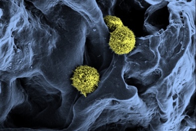 Đã có tuỷ xương nhân tạo